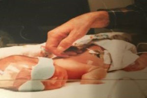 Michael as a baby in an incubator with his eyes covered to protect them.